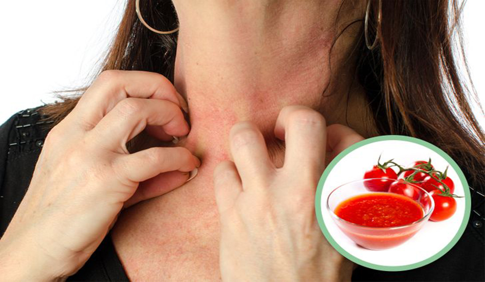 Eating too much tomato sauce can be harmful to your health