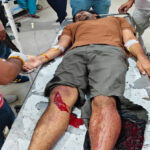 Sonipat: Accused in firing at Diler Kharkiya's Range Rover injured in encounter.